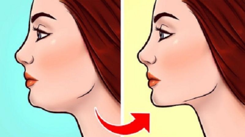 Kết quả của phương pháp Mewing