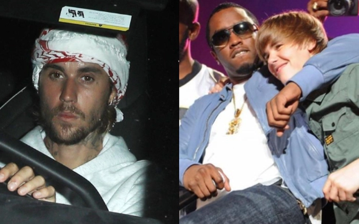 Fan xót xa khi Justin Bieber trông hốc hác và u sầu